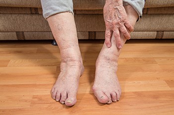 Common Causes of Foot Pain in Seniors