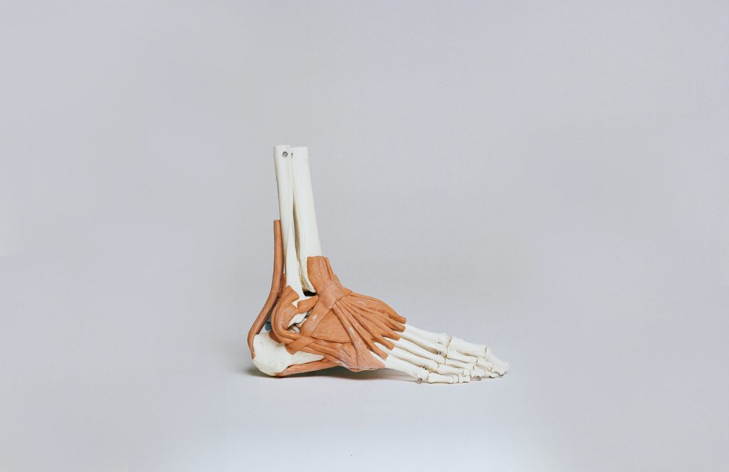 osteochondral lesion pain
